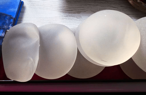 Augmentation mammaire : une intervention féminine très sollicitée ? © Dr Mitz, tous droits réservés 