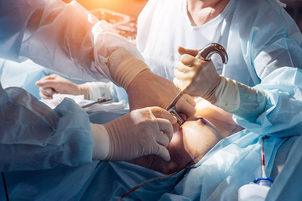 Introduction délicate d'une prothèse par voie sous mammaire. © Alfa27, Adobe stock