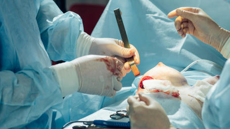 Chirurgie esthétique ratée