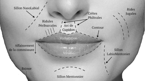 Les différentes parties des lèvres