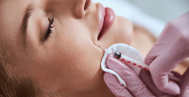 Sillons nasogéniens