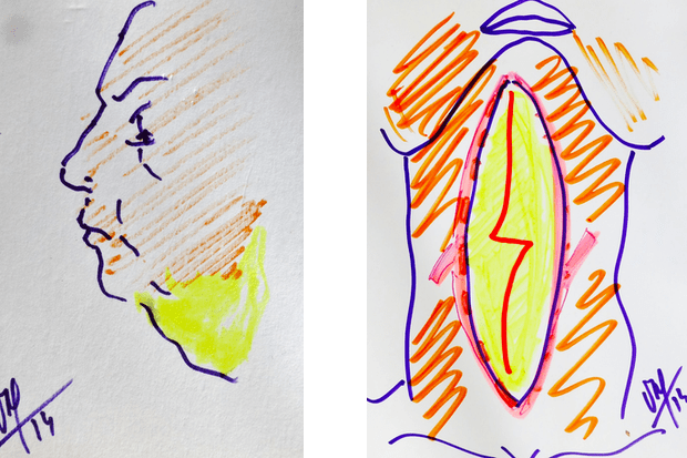 Résection avec plastie en Z