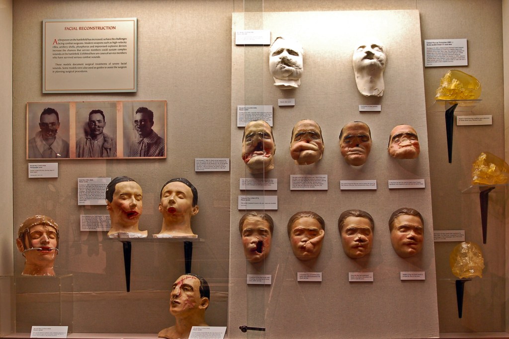 Chirurgie crano-faciale