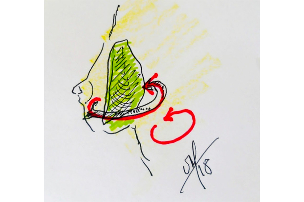 Retournement de prothèses